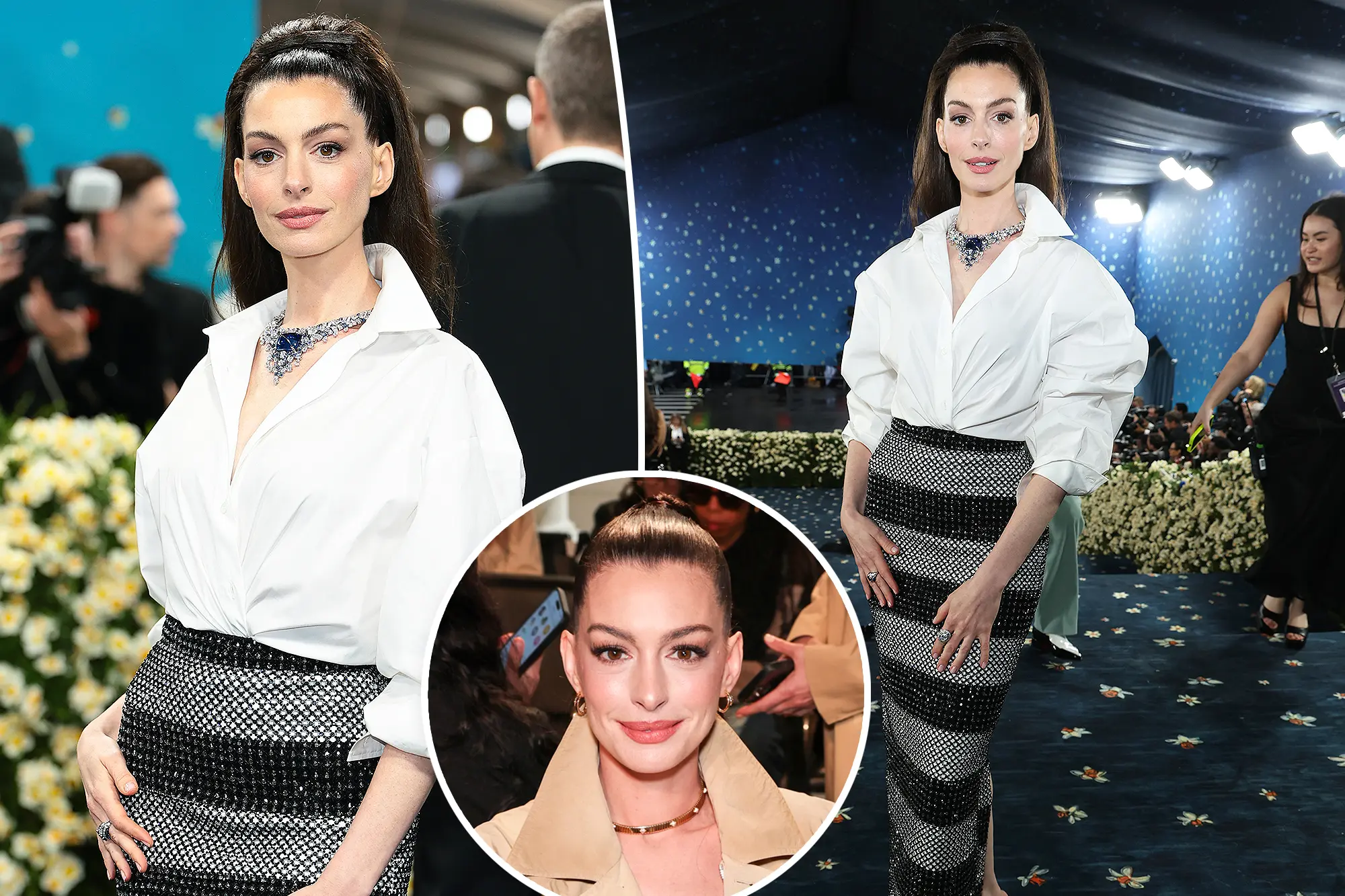 Anne Hathaway, 42, Looks Half Her Age at Met Gala 2025, Sparks Debate Over Cosmetic Procedures